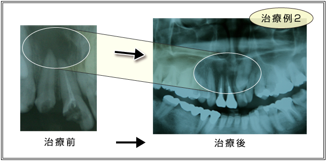 治療例2